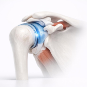 b862e8f9-posterior-capsule-tightness-the-silent-driver-of-impingement.png Posterior Capsule Tightness: The Silent Driver of Impingement