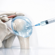 c07f4dc0-hydrodilatation-a-specialized-intervention-for-frozen-shoulder.png Hydrodilatation: A Specialized Intervention for Frozen Shoulder