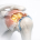 Fatty Infiltration: The Point of No Return in Rotator Cuff Tears?